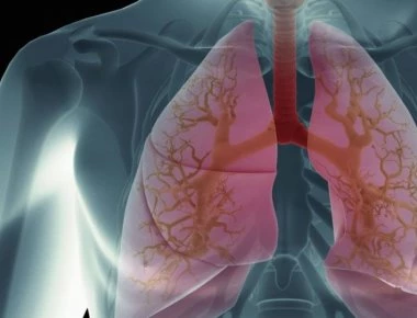 Πέθανε από καρκίνο γιατί της μεταμόσχευσαν τους πνεύμονες καπνίστριας!